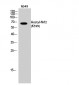 Nrf2 (Acetyl Lys599) Polyclonal Antibody
