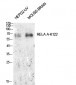 NFκB-p65 (Acetyl Lys122) Polyclonal Antibody
