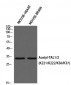 TAL1/2 (Acetyl Lys221/Acetyl Lys222/Acetyl Lys36/Acetyl Lys37) Polyclonal Antibody