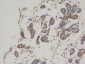 Bcl-2 Monoclonal Antibody(6B5)