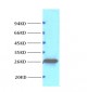 Bcl-2 Monoclonal Antibody(6B5)