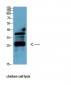 Bcl-2 Monoclonal Antibody(6B5)