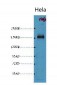 EGFR Monoclonal Antibody(1B10)