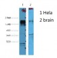 HER2 Monoclonal Antibody(11H9)
