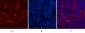 HER2 Monoclonal Antibody(11H9)