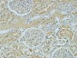 AMACR Monoclonal Antibody(4A12)