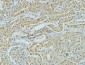 AMACR Monoclonal Antibody(4A12)