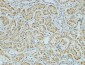 AMACR Monoclonal Antibody(4A12)