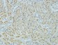 AMACR Monoclonal Antibody(4A12)