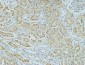 AMACR Monoclonal Antibody(4A12)