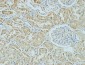 AMACR Monoclonal Antibody(4A12)