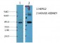 AMACR Monoclonal Antibody(4A12)