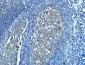 CD20 Monoclonal Antibody(2F4)