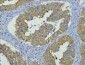 CK19 Monoclonal Antibody(11F5)