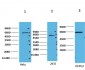NFkB p65 Monoclonal Antibody(14H2)