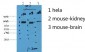 CK7 Monoclonal Antibody(12D7)