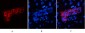 CK7 Monoclonal Antibody(12D7)