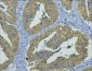 CK8 Monoclonal Antibody(8G8)