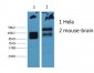 CK8 Monoclonal Antibody(8G8)