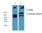 CK8 Monoclonal Antibody(8G8)