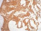 CK16 Monoclonal Antibody(6F6)