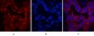 CK16 Monoclonal Antibody(6F6)