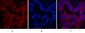 CK16 Monoclonal Antibody(6F6)