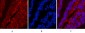 CK16 Monoclonal Antibody(6F6)