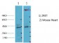 CDX2 Monoclonal Antibody(14H6)