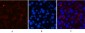 CD21 Monoclonal Antibody(2C5)