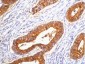 Carcinoembryonic Antigen Monoclonal Antibody(10E1)