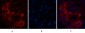 Carcinoembryonic Antigen Monoclonal Antibody(10E1)