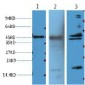Aquaporin 4 Monoclonal Antibody(4H1)