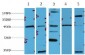 β-Catenin Monoclonal Antibody(13C6)