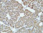 NSE Monoclonal Antibody(13E2)