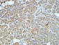 NSE Monoclonal Antibody(13E2)