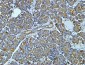 NSE Monoclonal Antibody(13E2)