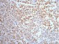 NSE Monoclonal Antibody(13E2)