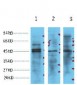 NSE Monoclonal Antibody(13E2)