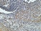 CD4 Monoclonal Antibody(11A1)
