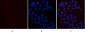 CD10 Monoclonal Antibody(5B8)