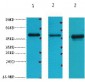 FH Monoclonal Antibody(7F1)