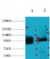 ABCB5 Monoclonal Antibody(11A2)