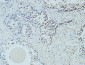 AFP alpha 1 Fetoprotein Monoclonal Antibody(17C5)