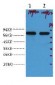 AFP alpha 1 Fetoprotein Monoclonal Antibody(17C5)