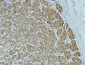 CA IX Monoclonal Antibody(12F10)