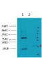 CA IX Monoclonal Antibody(12F10)
