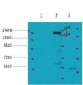 HER2 Monoclonal Antibody(3C9)