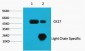 CK17 Monoclonal Antibody(10A1)