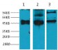 CK17 Monoclonal Antibody(10A1)